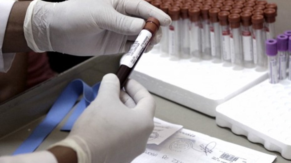 Laboratorio Referencia dispone de pruebas para detección del Zika 