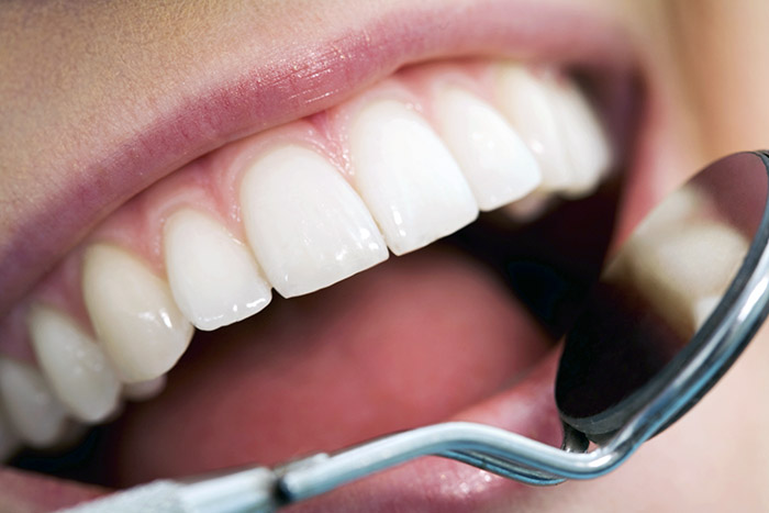 Método permitiría regenerar encía alrededor de los implantes dentales 