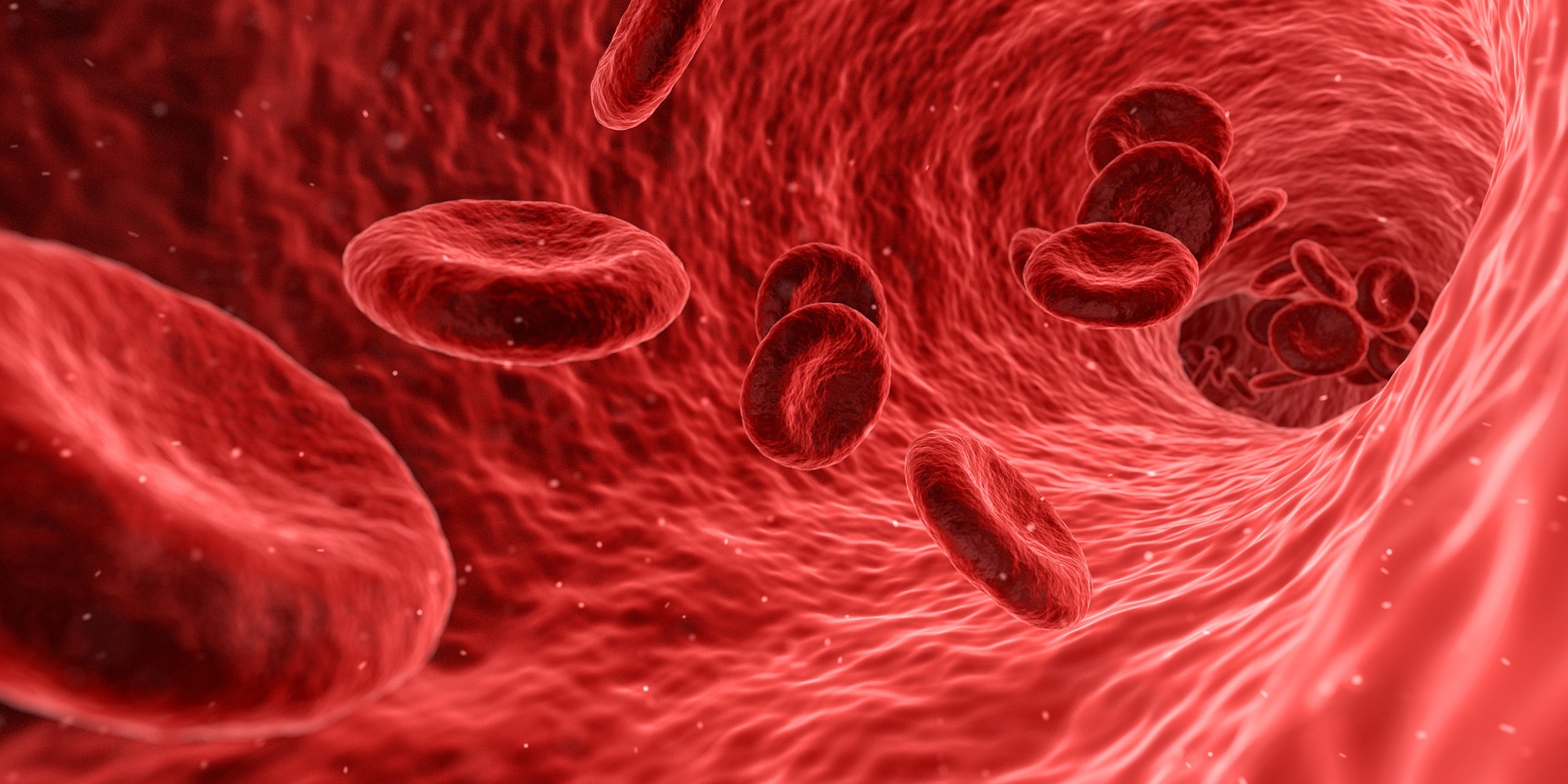 Hematólogos se actualizan sobre síndromes mieloproliferativos crónicos 