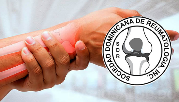 Reumatólogos invitan actividad sobre Lupus 