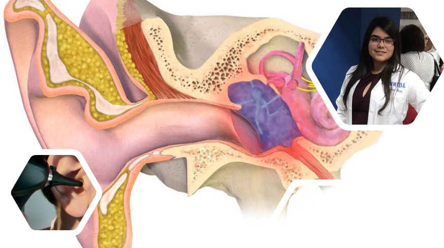 Caso Clínico: Otitis Media Aguda 