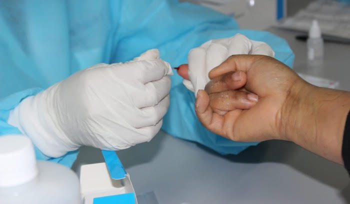 Bioanalistas realizan más de 80 millones pruebas de laboratorios en la Red Pública 