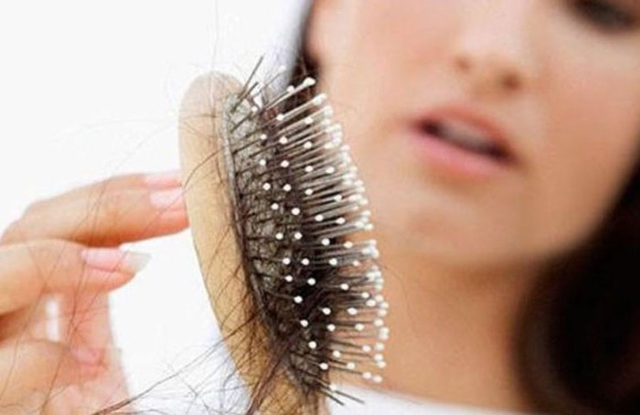 La alopecia androgénica no se relaciona con síntomas depresivos 