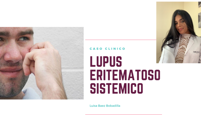 Caso clínico: Lupus Eritematoso Sistémico 