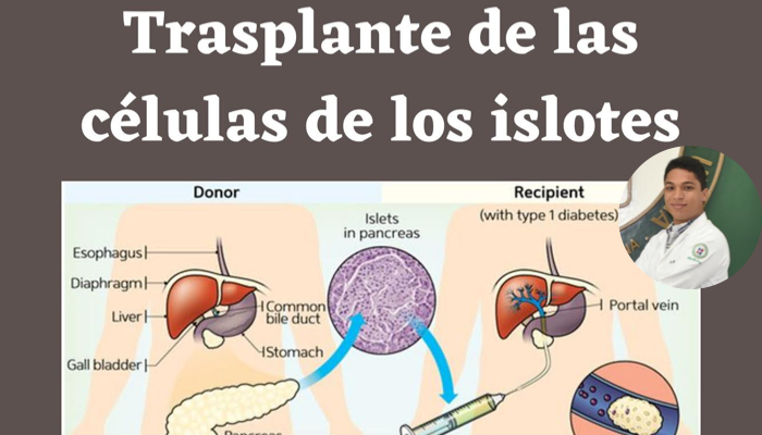 Trasplante de las células de los islotes 