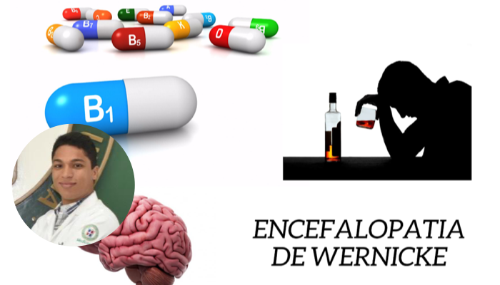 Encefalopatía de Wernicke 