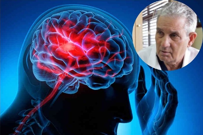 Día Mundial del Cerebro, especialista advierte sobre daño cerebral por  Covid-19 
