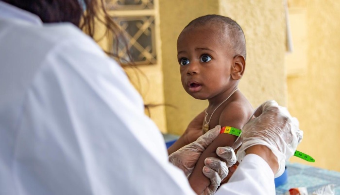 115 milímetros, la medida que alerta de la desnutrición infantil 