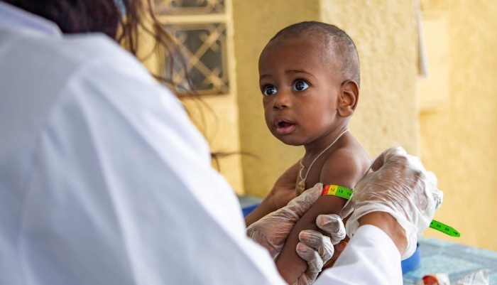 Advierten  6,7 millones de niños podrían sufrir malnutrición en 2020 debido a la pandemia 