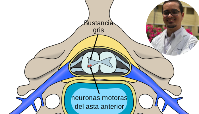 Sinopsis sobre la atrofia muscular espinal 