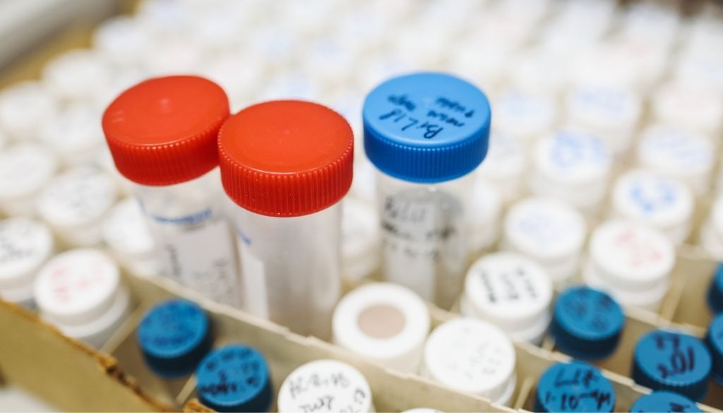 Advierten también se debe incluir  Hepatitis B en catálogo SS 