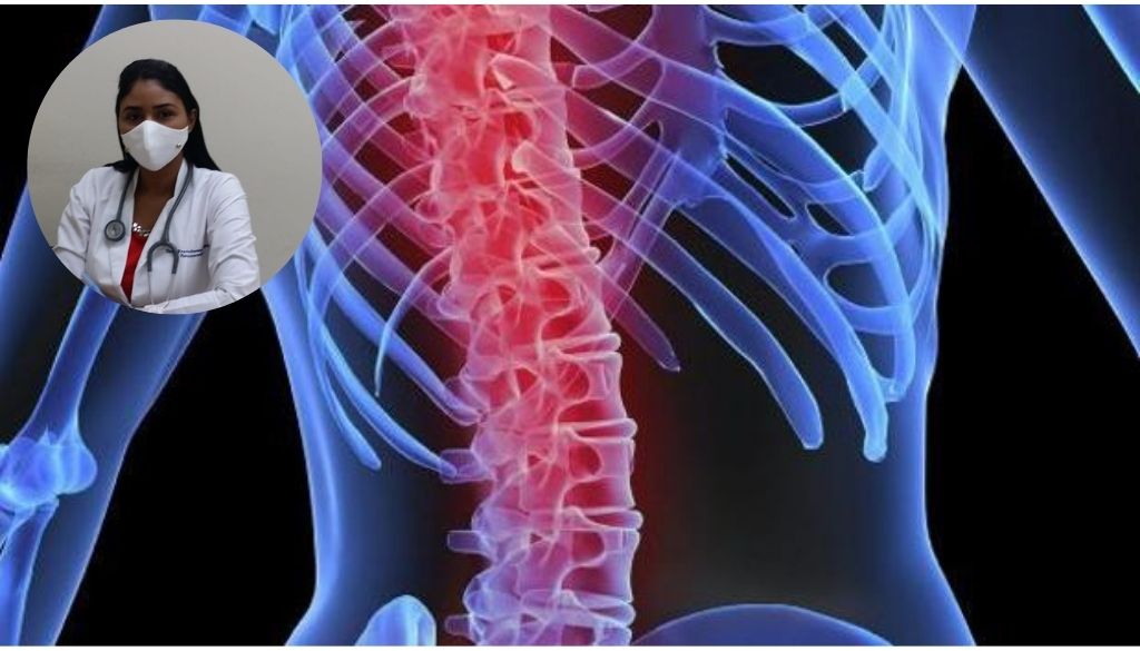 Reumatóloga destaca importancia estudios imágenes para detectar osteoporosis 