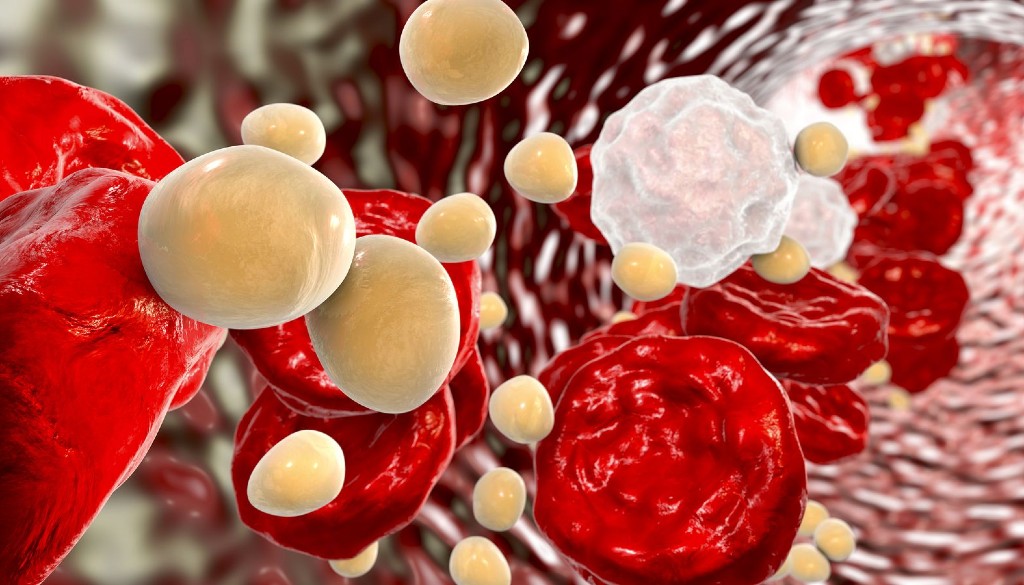 FDA aprueba primer tratamiento para la enfermedad de Niemann-Pick tipo C 