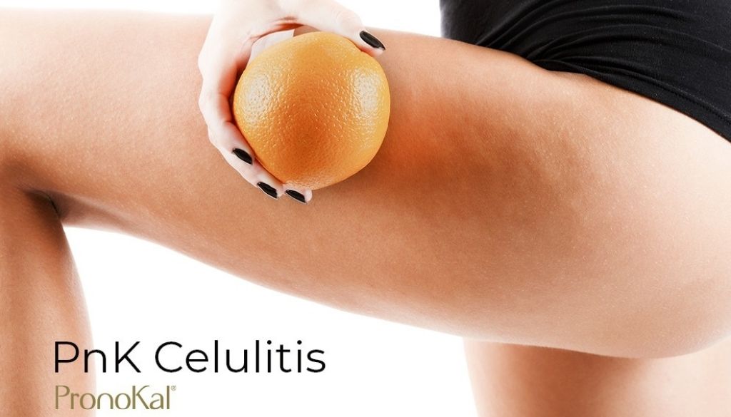 Presentan programa para combatir celulitis y flacidez 