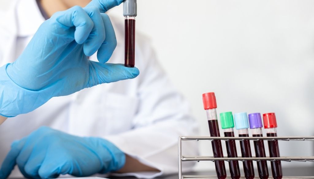Desarrollan una prueba de análisis de sangre que permite detectar 50 tipos de cáncer 