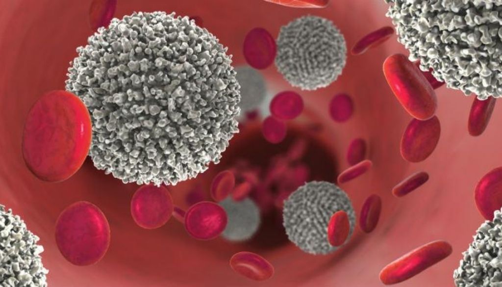 Descubren un nuevo perfil metabólico en pacientes de leucemia mieloide aguda 