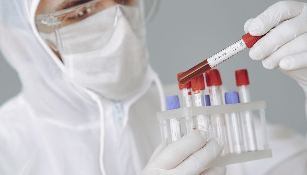 Coronavirus en RD: 216 casos nuevos en las últimas 24 horas 