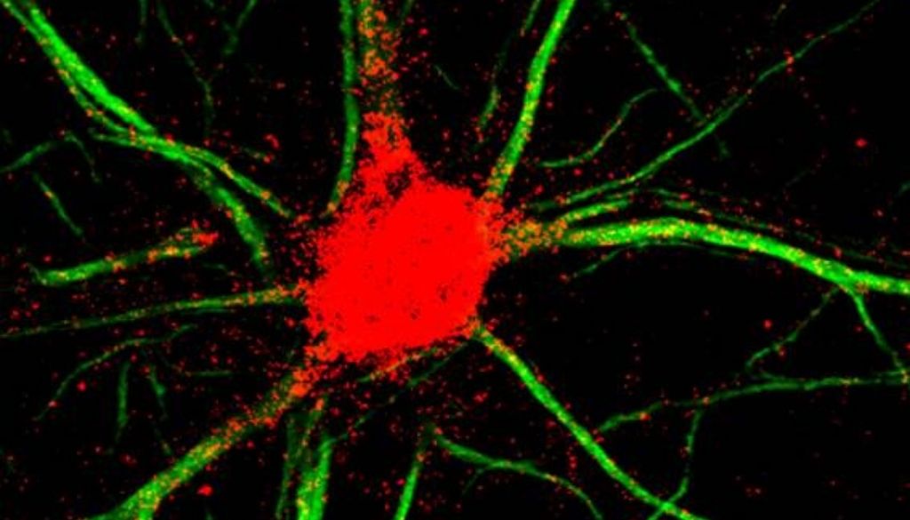 Descifran mecanismos cerebrales clave en el funcionamiento de la memoria de trabajo 