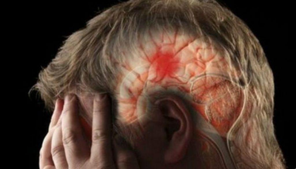 FDA aprueba primera terapia de rehabilitación sin medicamentos para derrames cerebrales 