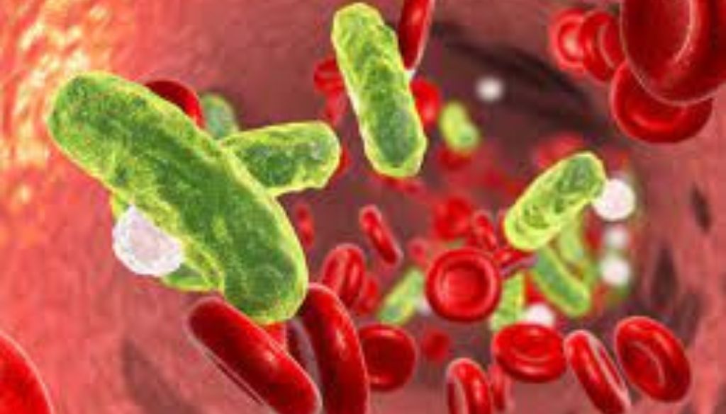 Advierten más del 40% de las muertes por sepsis ocurren en menores de 5 años 