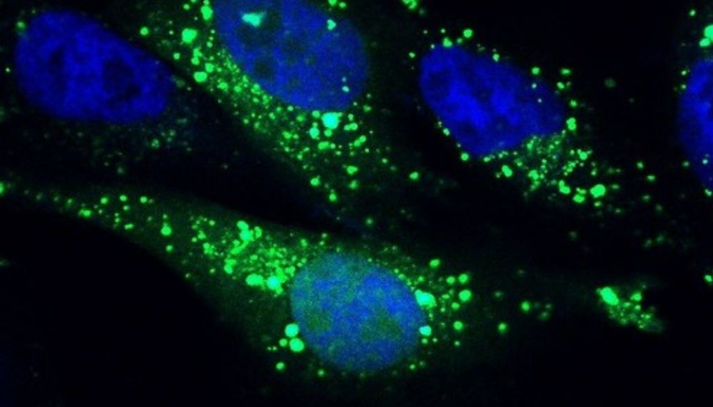 Identifican un nuevo mecanismo que regula la autofagia celular 