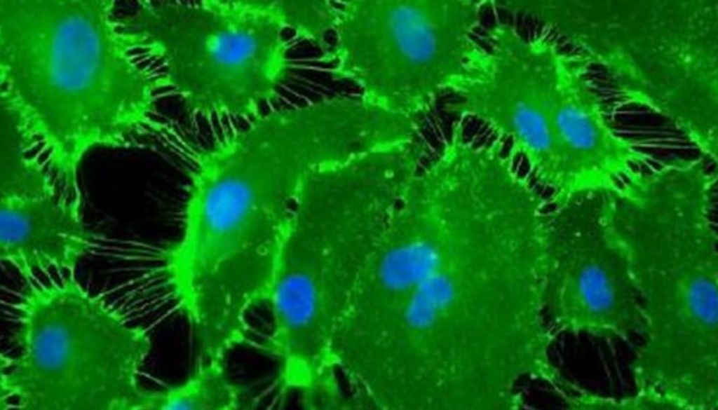 Estudian mecanismos fisiopatológicos que intervienen en desarrollo de hipertensión pulmonar tromboembólica crónica 