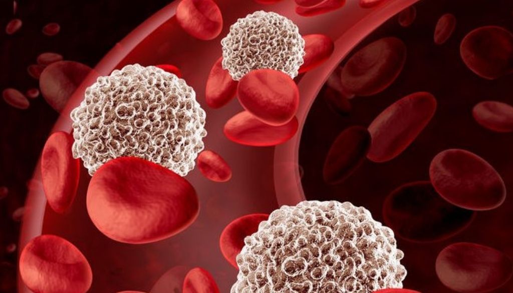 Logran mejorar tratamiento de la anemia aplásica 
