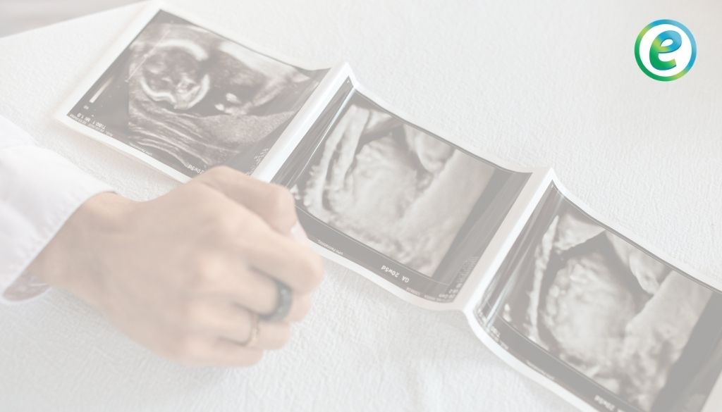 Medicina y POCUS 