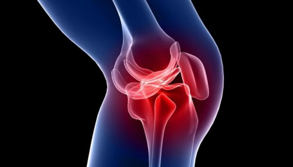 El cartílago que vuelve a crecer en una rodilla dañada se acerca más a la reparación de la artritis 