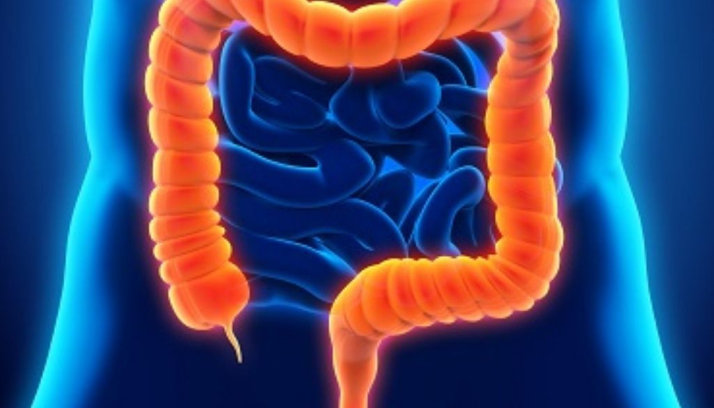 Hallan una conexión entre el metabolismo de glucosa y tumores colorrectales 