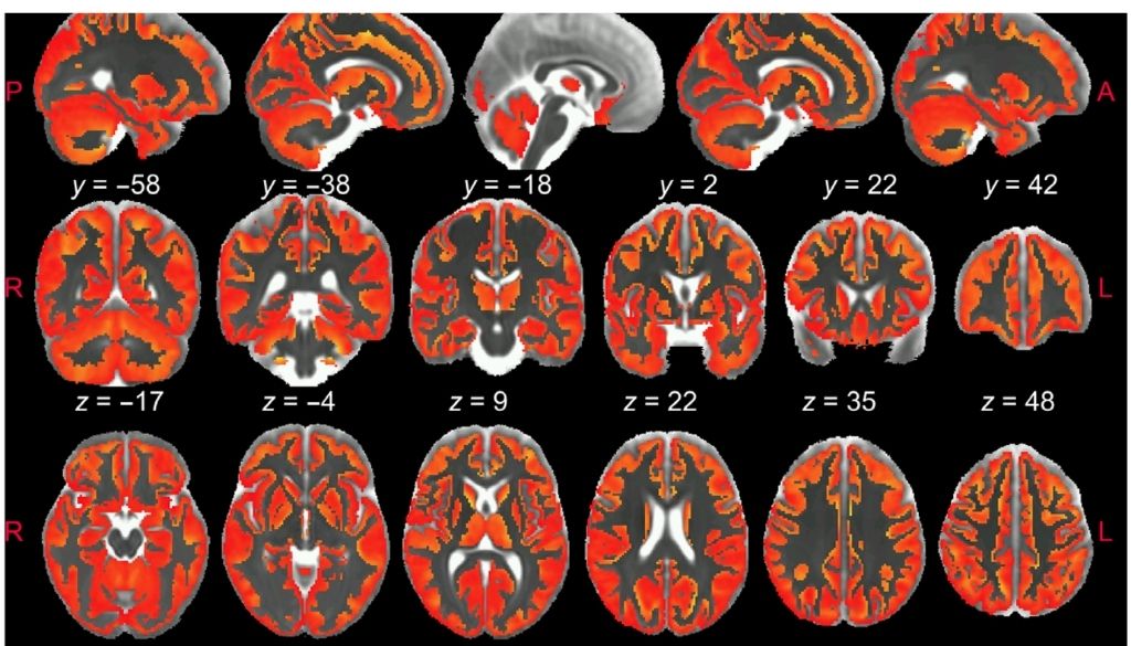 Las nuevas fronteras en la investigación del cerebro: IA, neuromodulación y el futuro de la neurociencia 