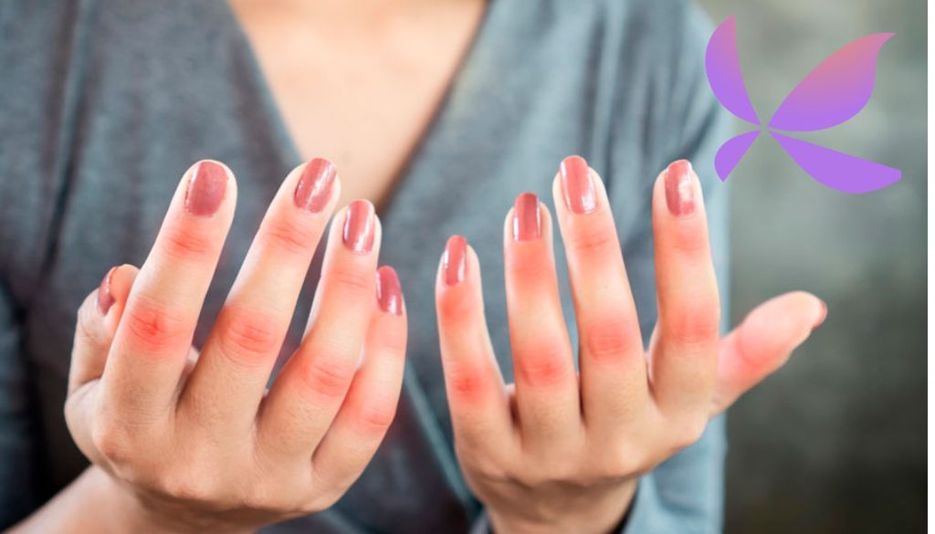 Proteína recombinante revierte estado proinflamatorio de células pacientes con lupus 