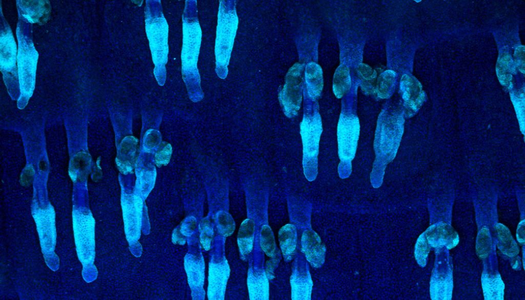 Identifican proteínas que modulan el comportamiento células madre de la piel 