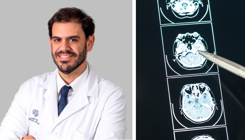 Expertos inciden necesidad investigar trastorno del sueño en pacientes con ELA 