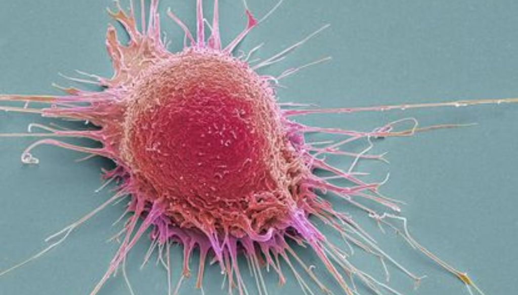 Identifican nuevos mecanismos del cáncer de vías biliares 