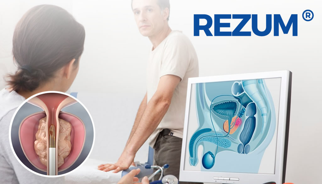 REZUM revolucionario tratamiento para pacientes con afecciones de próstata  
