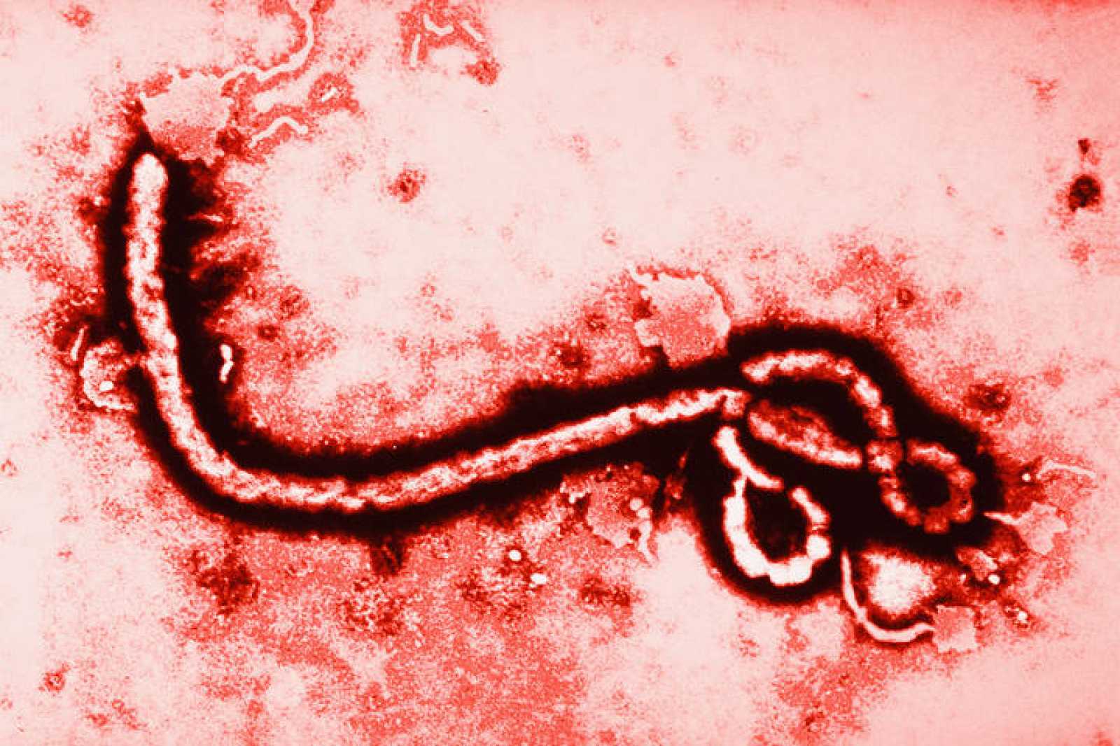 OMS emite recomendaciones para tratar ébola 
