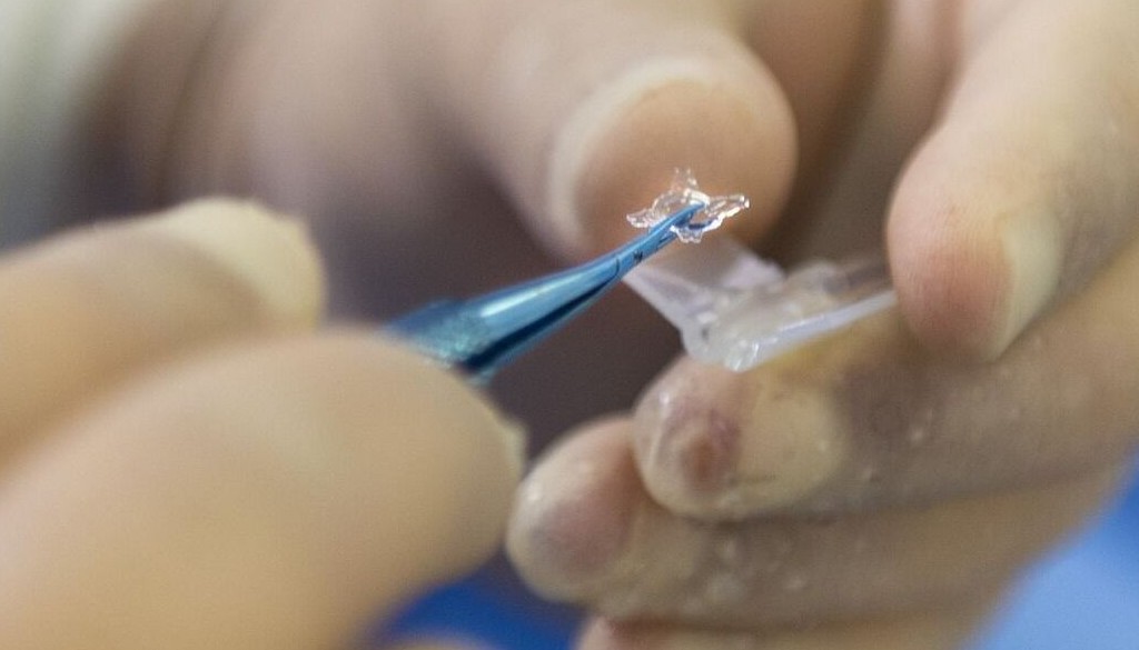 La OMS confirma una tercera muerte por el virus de Marburgo en Ghana 