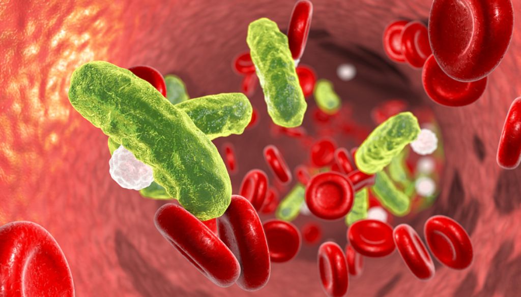 Estudio revela deficiencias en  detección y gestión de sepsis en hospitales 
