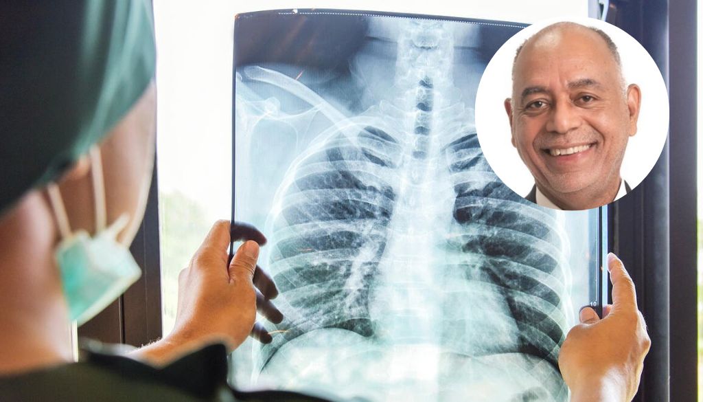 Afirman sólo tres de cada 100 personas con cáncer de pulmón sobreviven a cinco años  