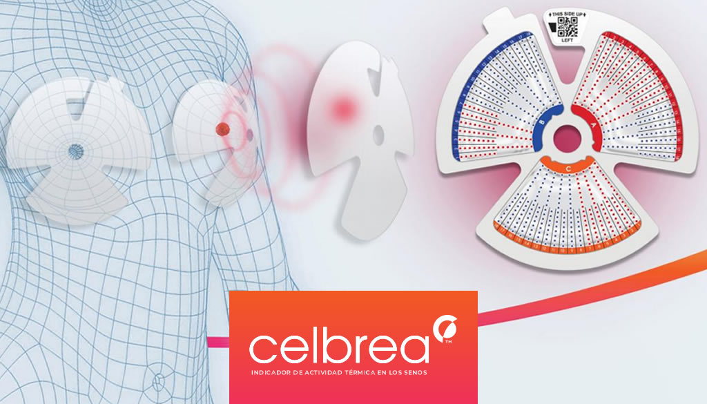 Celbrea, tecnología que contribuye con la detección de anomalías mamarias 