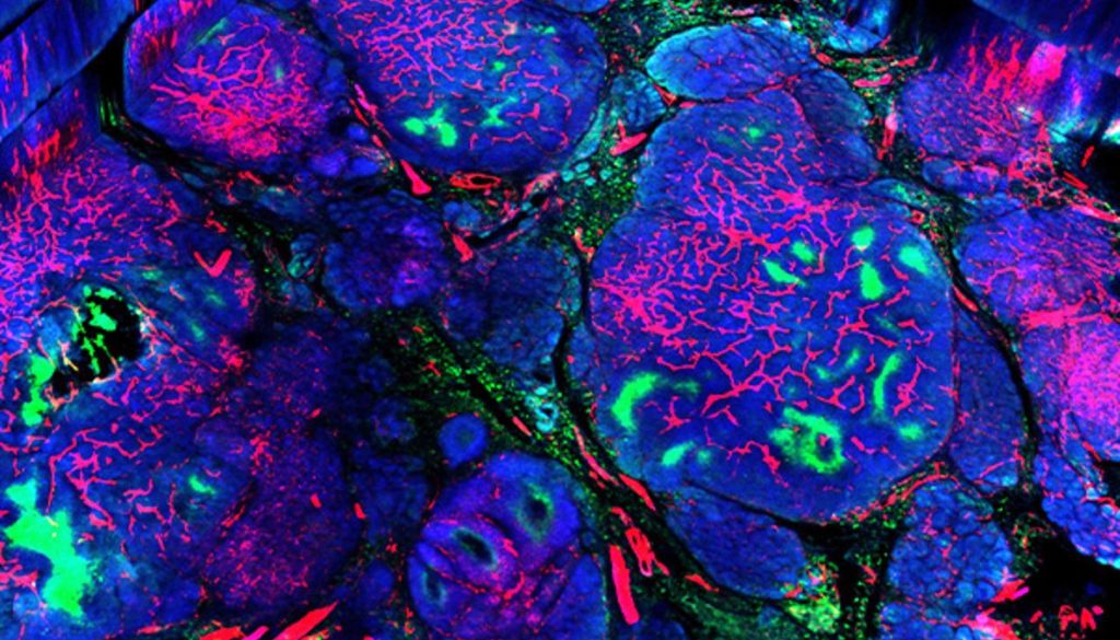 Potencial de vectores lentivirales se abre paso en las terapias contra el cáncer 