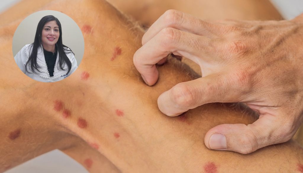 Dermatóloga insta estar alertas a lesiones en la piel  