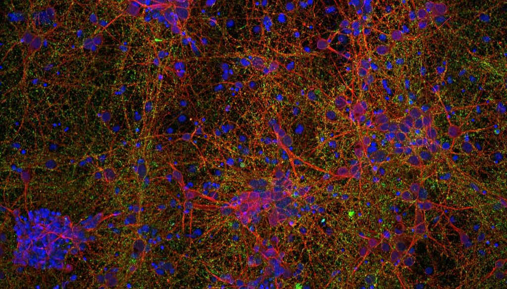 Emplearán nanotecnología para reparar lesiones medulares 