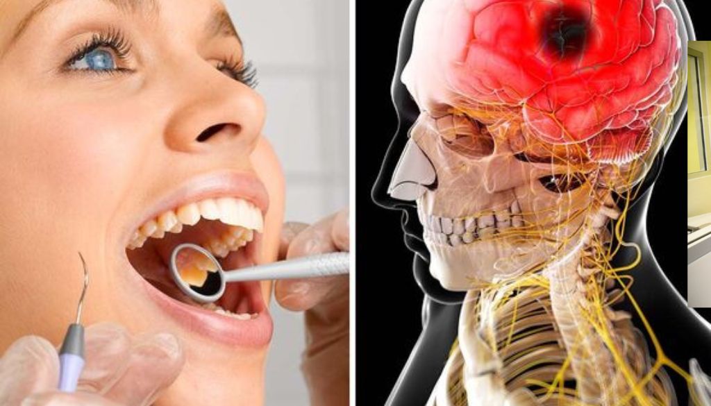 La mala salud oral puede afectar el cerebro 