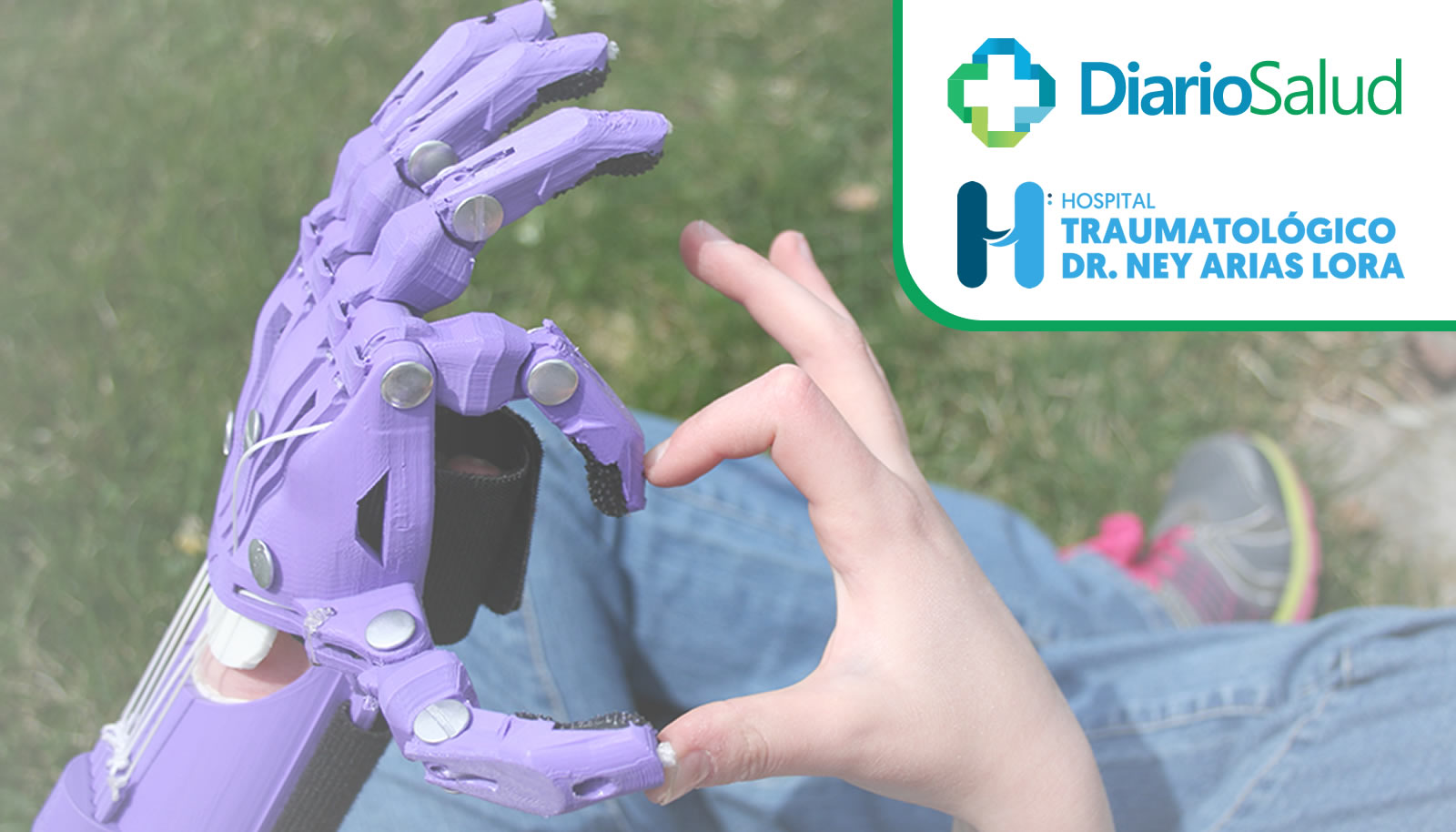 Estamos en busca de pacientes para donaciones de prótesis de mano…¡Ayúdanos a ayudar! 