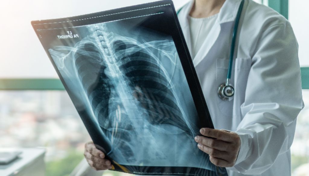 Realizarán 2do curso de actualización en radiología 