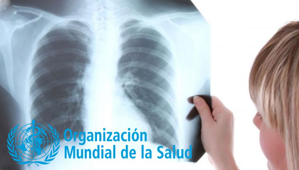 OMS anuncia la primera precalificación de una prueba diagnóstica de tuberculosis 