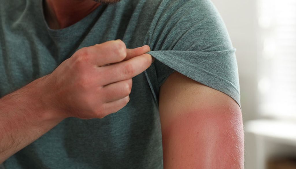 Advierten trabajar bajo el sol aumenta muertes por cáncer de piel 