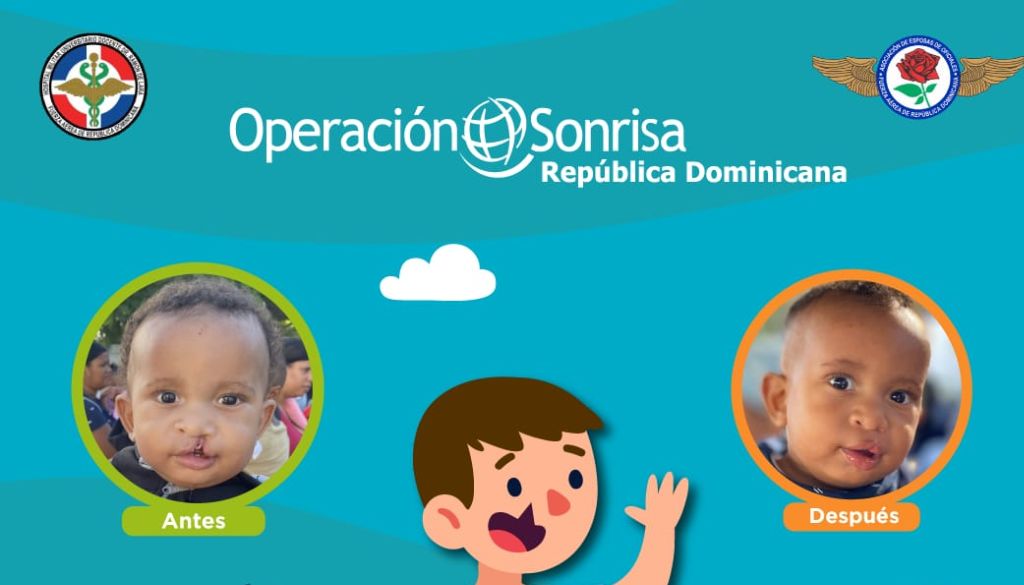 Realizarán jornada quirúrgica gratuita de Labio y Paladar Hendido 